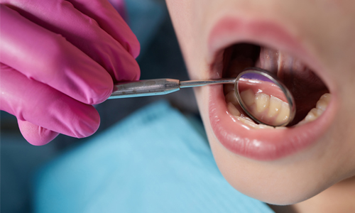Child dental exam